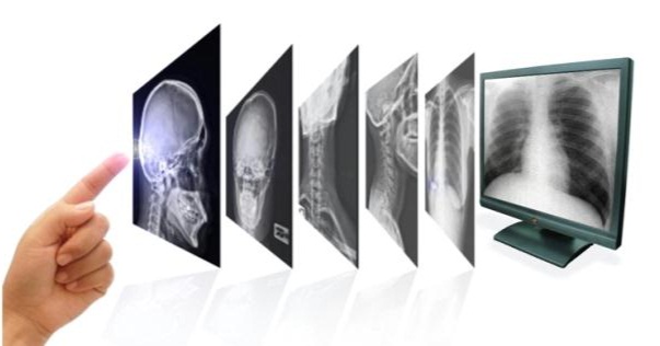 evolucion de la radiografia
